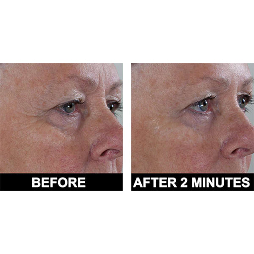 ADONIA Peptide 10