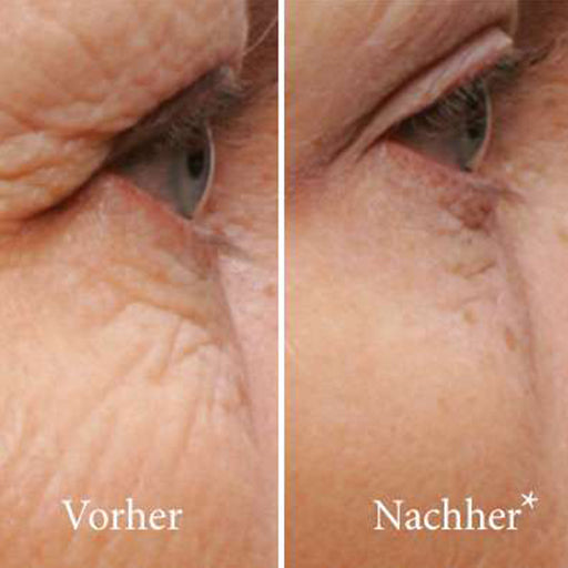 ATHENA 7 Minute Lift