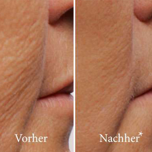 ATHENA 7 Minute Lift