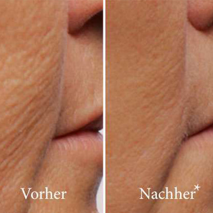 ATHENA 7 Minute Lift