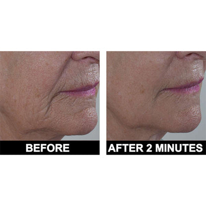 ADONIA Peptide 10