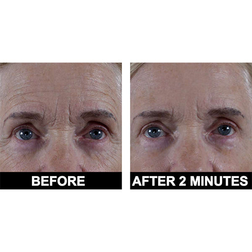 Beauty Set 4: StemuLift & Peptide 10