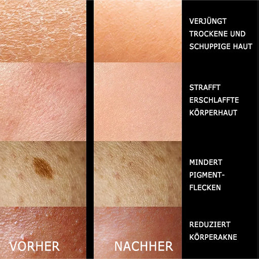 ADONIA StemuTone